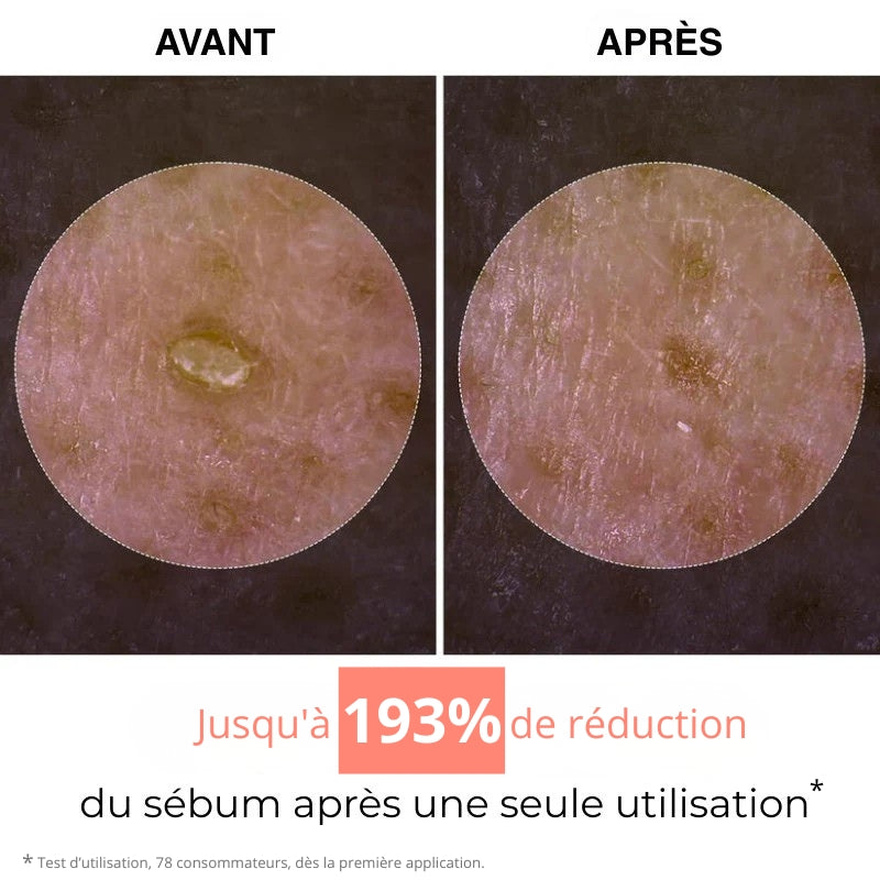 Gamme routine anti imperfections - Peel shoot