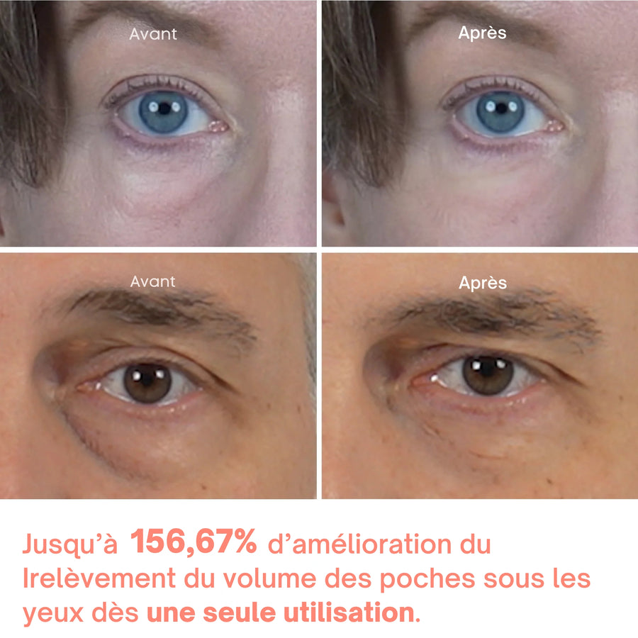 Eyephalt - Crème pour les poches sous les yeux