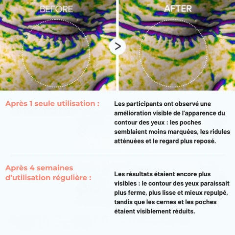 Eyephalt - Crème pour les poches sous les yeux